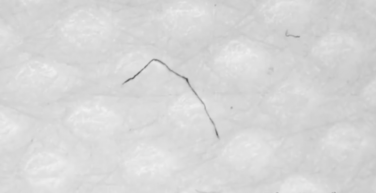 covid masks, covid swabs, worms in masks, parasitic worms, worm like micelles