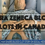 Astra Zeneca Blood Clots in Canada