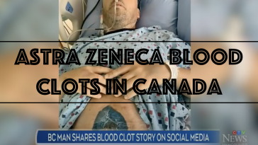 Astra Zeneca Blood Clots in Canada