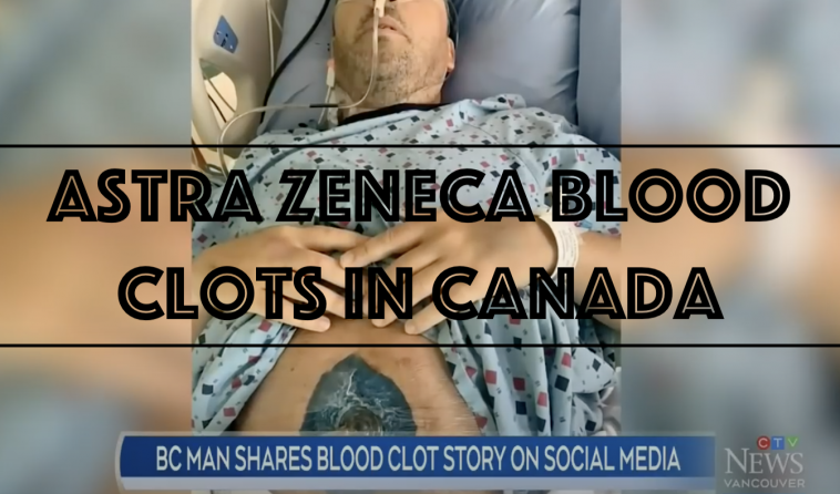 Astra Zeneca Blood Clots in Canada