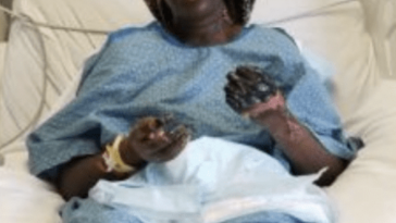 bilateral transtibial amputation from the Jab. When will this stop? Plandemic