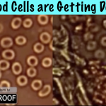 Red Blood Cells are Getting Destroyed