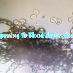 What is Happening To Blood After The Vaccines?