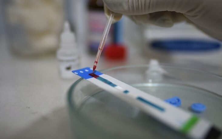 Fast-spreading-HIV-variant-doubles-rate-of-immune-system-decline