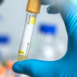 10 More States Report Mysterious Hepatitis Outbreaks in Children