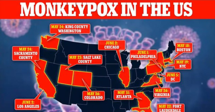 CDC advises travelers to wear MASKS to protect against monkeypox as it raises alert level and confirms 31 cases in the US including seven in New York and six in California