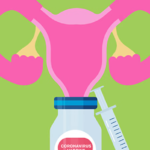 Covid Vaccines and Infertility