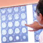 Bombshell Possible Fraudulent Images Used In Key Alzheimer’s Study Has Misled Research For Years, Report Says