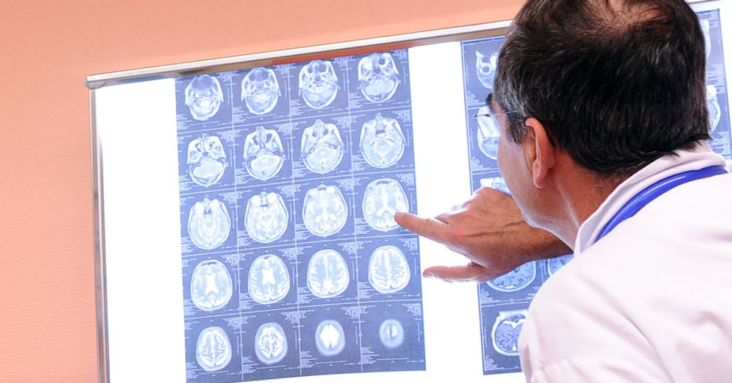 Bombshell Possible Fraudulent Images Used In Key Alzheimer’s Study Has Misled Research For Years, Report Says