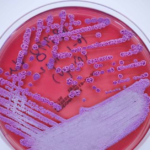 Deadly bacteria that causes meliodosis detected in Mississippi water, CDC reveals First time cause of disease similar to TB has ever been found in the US