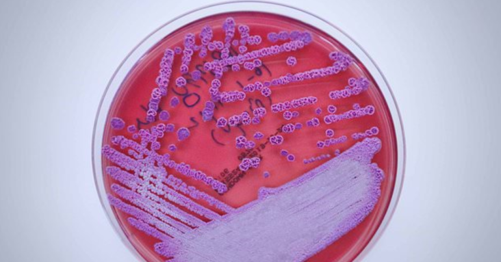 Deadly bacteria that causes meliodosis detected in Mississippi water, CDC reveals First time cause of disease similar to TB has ever been found in the US