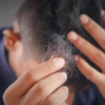 Long COVID: New study reveals more symptoms including hair loss and erectile dysfunction