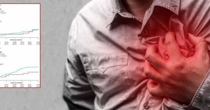 New Study Confirms Heart Inflammation Spike Cannot Be Attributed to ‘Long Covid’