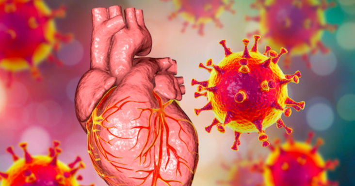 Catecholamines Are the Key Trigger of COVID-19 mRNA Vaccine-Induced Myocarditis: A Compelling Hypothesis Supported by Epidemiological, Anatomopathological, Molecular, and Physiological Findings