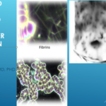 Computerized Thermographic Imaging and Live Blood Analysis post C19 injection