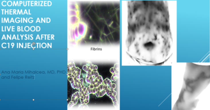 Computerized Thermographic Imaging and Live Blood Analysis post C19 injection