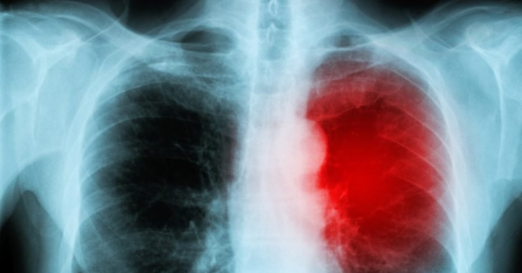 First Child Myocarditis Advertisement Airs: Is Myocarditis In Children Being Normalized?