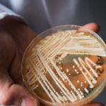 Deadly fungal infection spreading at an alarming rate, CDC says