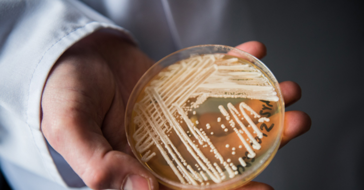 Deadly fungal infection spreading at an alarming rate, CDC says