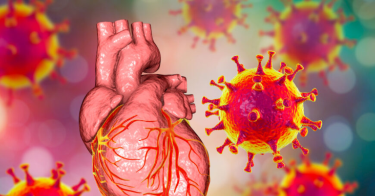 Autopsy Studies of COVID-19 Illness Rule Out Extensive Myocarditis