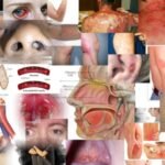 1000 peer reviewed articles on “Vaccine” injuries