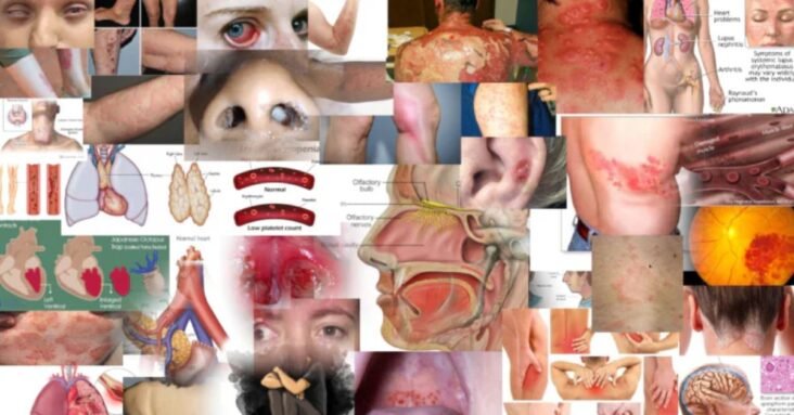 1000 peer reviewed articles on “Vaccine” injuries