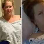 Amy Schumer Says She Developed VAIDS After Third Booster