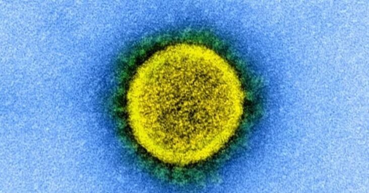 Info request yields no documents on how Saskatchewan defined COVID-19 deaths