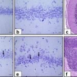 Prenatal Exposure to COVID-19 mRNA Vaccine BNT162b2 Induces Autism-Like Behaviors in Male Neonatal Rats Insights into WNT and BDNF Signaling Perturbations