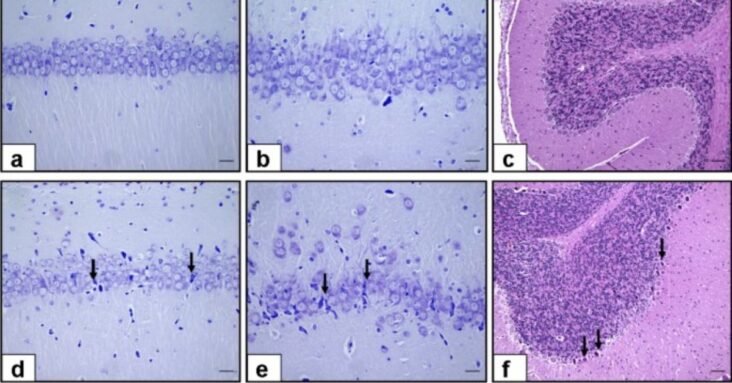 Prenatal Exposure to COVID-19 mRNA Vaccine BNT162b2 Induces Autism-Like Behaviors in Male Neonatal Rats Insights into WNT and BDNF Signaling Perturbations