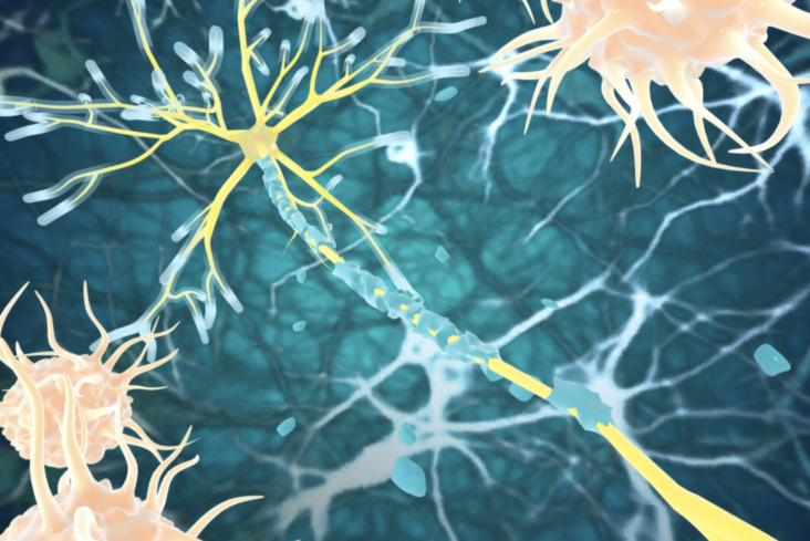 CDC officials are investigating a potential link between two recently approved RSV vaccines and increased reports of Guillain-Barré syndrome in adults over 60.