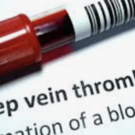 Japanese researchers warn about the risks of blood transfusions from covid vaccinated people