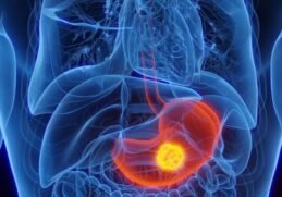 Doctors Warn of Mysterious Cancer ‘Epidemic’