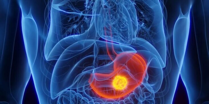 Doctors Warn of Mysterious Cancer ‘Epidemic’